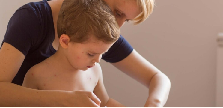 Bild - Vilka är symtomen?